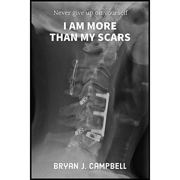 I Am More Than My Scars - Never Give Up On Yourself, Bryan Campbell