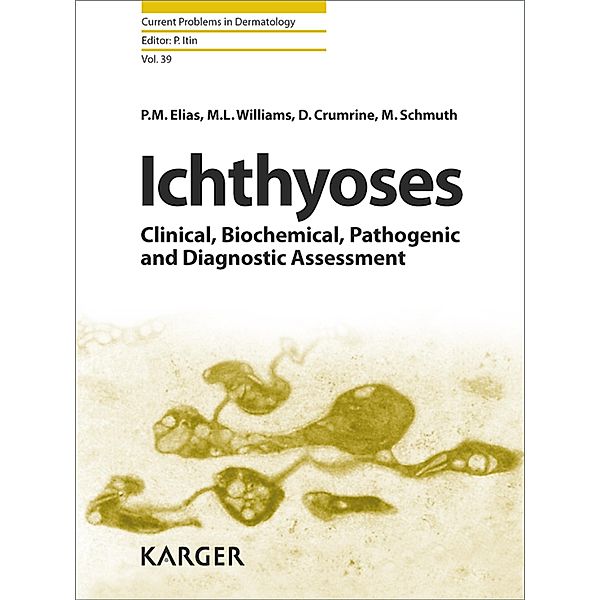 Ichthyoses, Crumrine, D. Crumrine, Elias, P. M. Elias, Schmuth, M. Schmuth, Williams, M. L. Williams