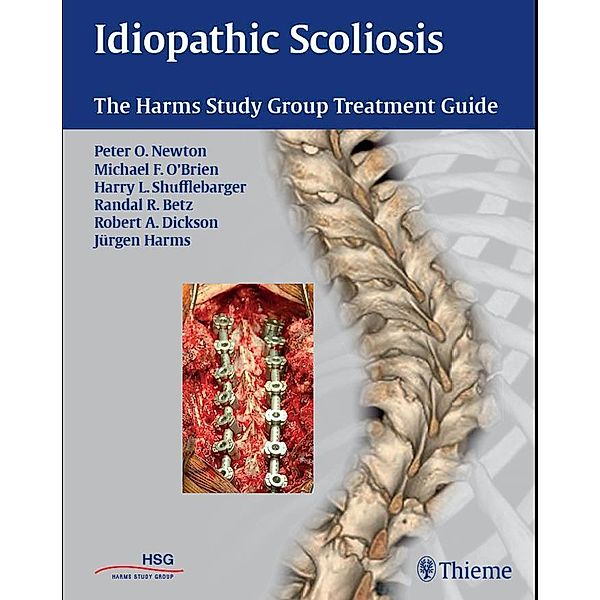 Idiopathic Scoliosis / Thieme