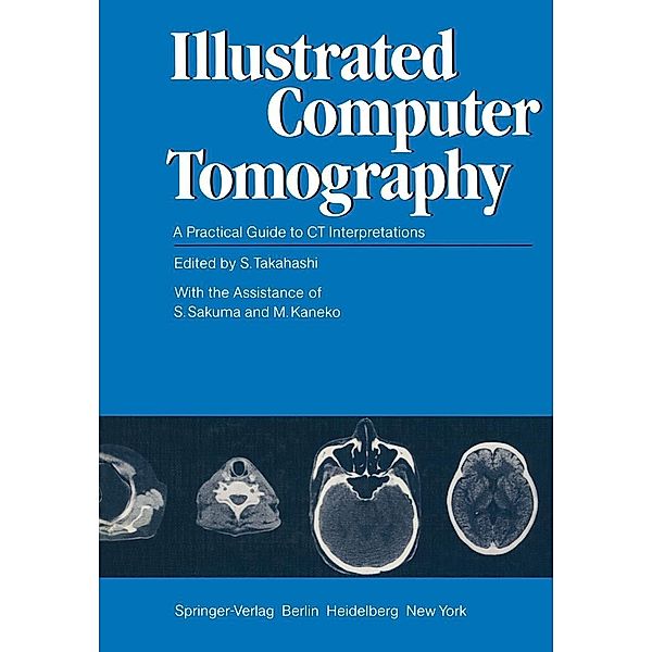 Illustrated Computer Tomography