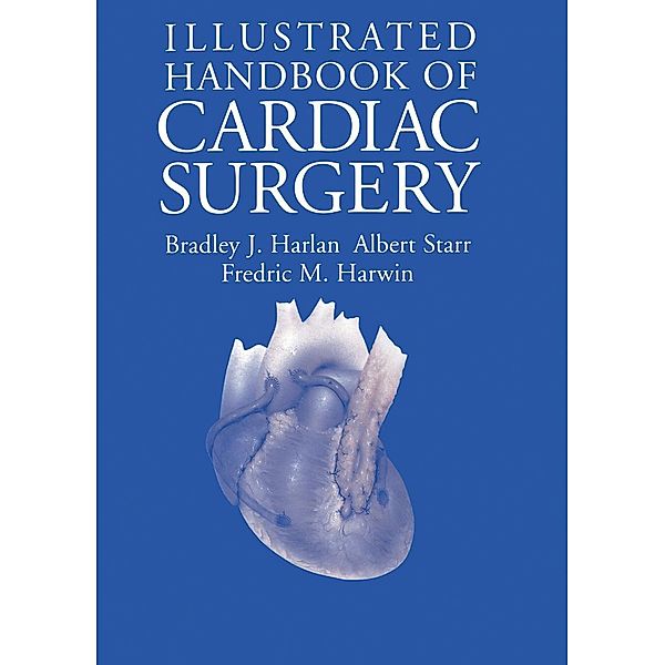 Illustrated Handbook of Cardiac Surgery, Bradley J. Harlan, Albert Starr, Fredric M. Harwin