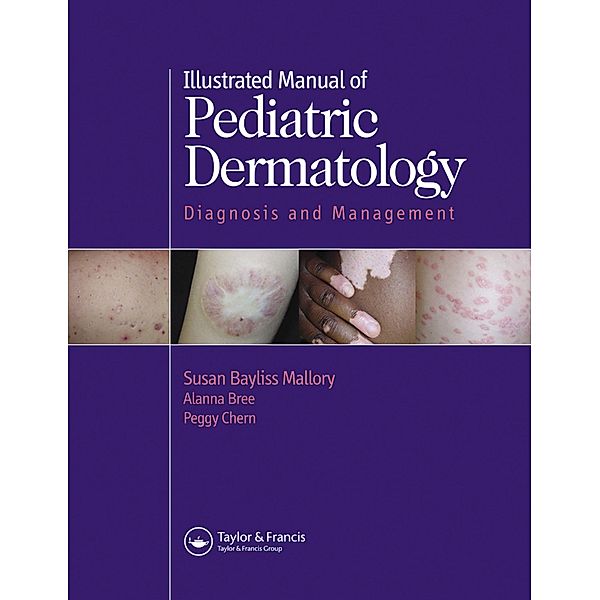 Illustrated Manual of Pediatric Dermatology, Susan Mallory, Alanna F. Bree, Peggy Chern
