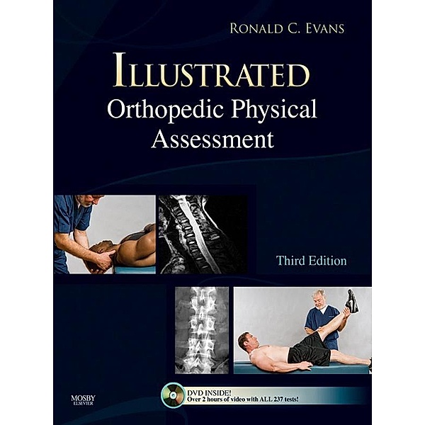 Illustrated Orthopedic Physical Assessment, Ronald C. Evans