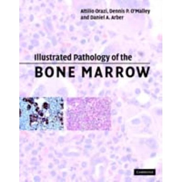 Illustrated Pathology of the Bone Marrow, Attilio Orazi