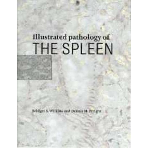 Illustrated Pathology of the Spleen, Bridget S. Wilkins