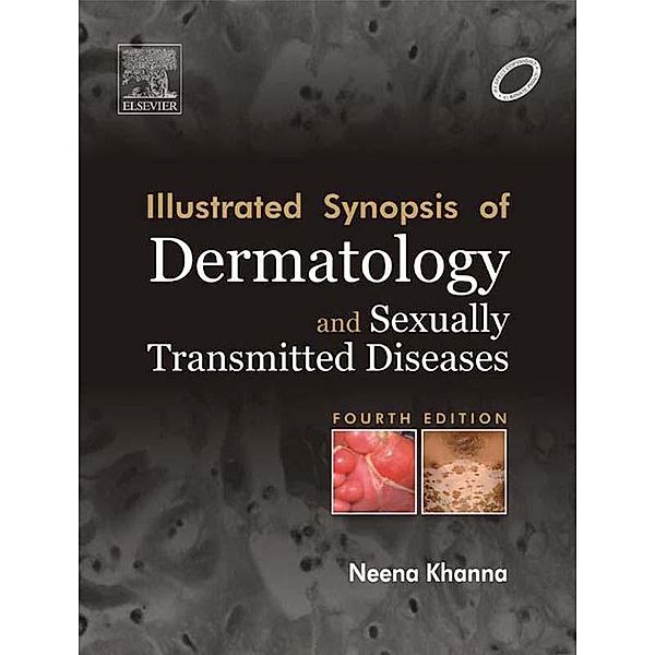 Illustrated Synopsis of Dermatology & Sexually Transmitted Diseases - E-book, Neena Khanna