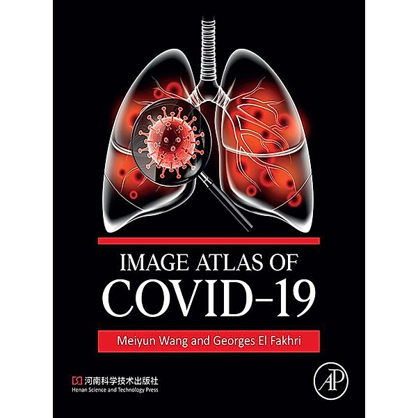 Image Atlas of COVID-19, Meiyun Wang, Georges El Fakhri