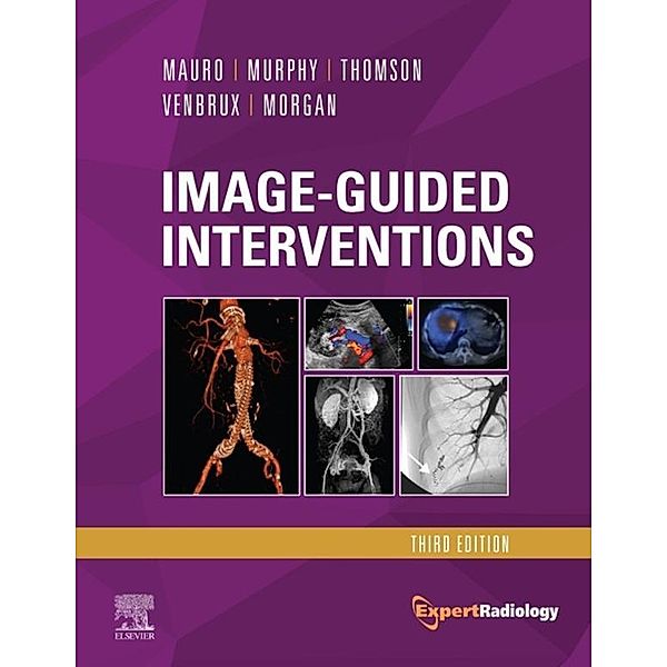 Image-Guided Interventions E-Book, Kenneth R. Thomson