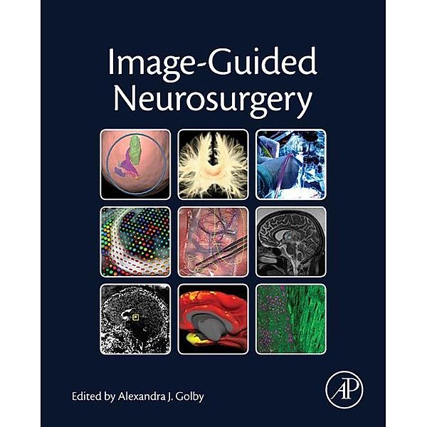 Image-Guided Neurosurgery