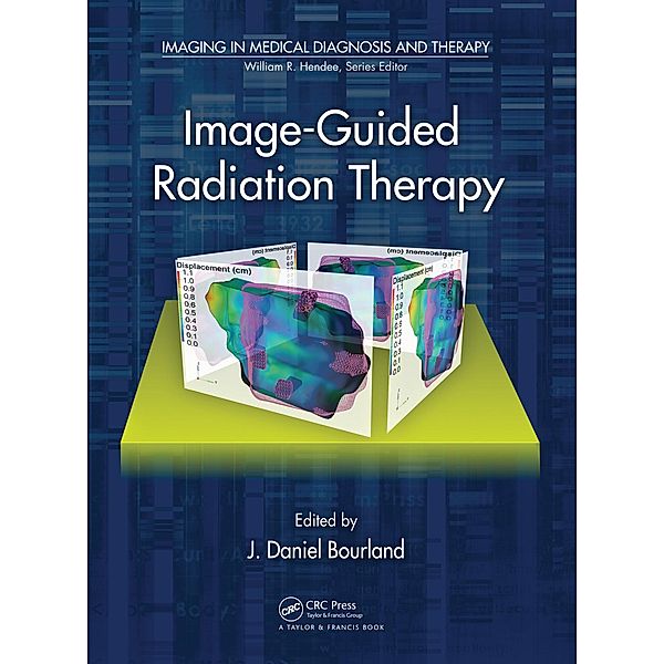 Image-Guided Radiation Therapy