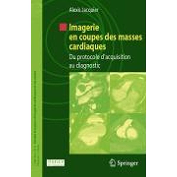 Imagerie en coupes des masses cardiaques / Collection de la Société française d'imagerie cardiaque et vasculaire, Alexis Jacquier