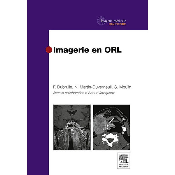 Imagerie en ORL, Nadine Martin-Duverneuil, Arthur Varoquaux, Guy Moulin, Frédérique Dubrulle