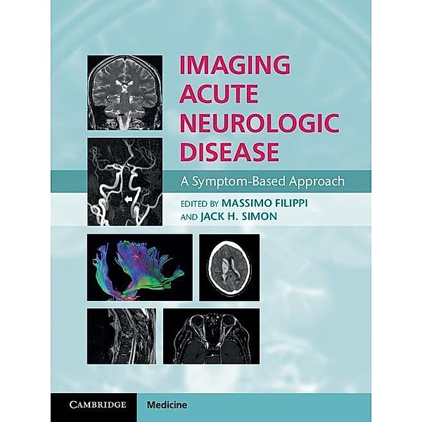 Imaging Acute Neurologic Disease