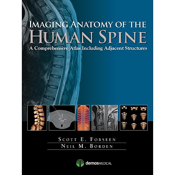 Imaging Anatomy of the Human Spine, Scott E. Forseen, Neil M. Borden