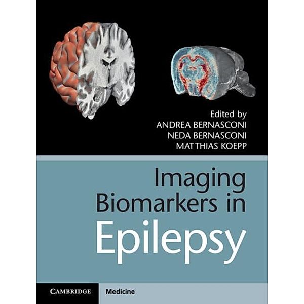 Imaging Biomarkers in Epilepsy