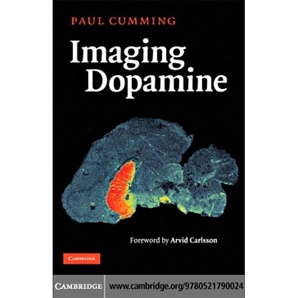 Imaging Dopamine, Paul Cumming