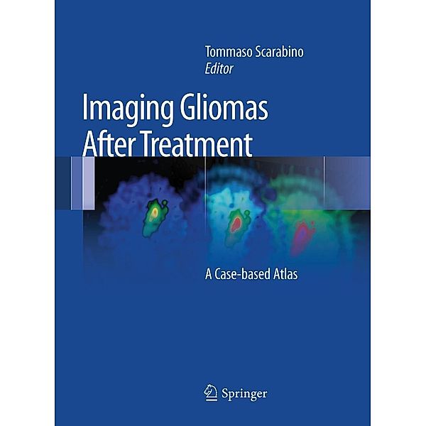 Imaging Gliomas After Treatment