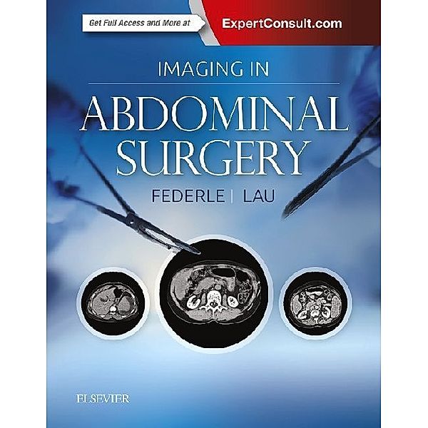 Imaging in Abdominal Surgery, Michael P Federle, James Lau