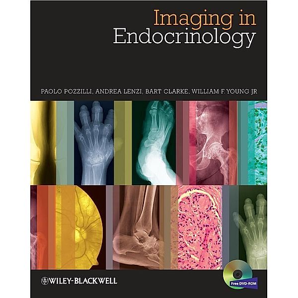 Imaging in Endocrinology, Paolo Pozzilli, Andrea Lenzi, Bart L. Clarke, William F. Young