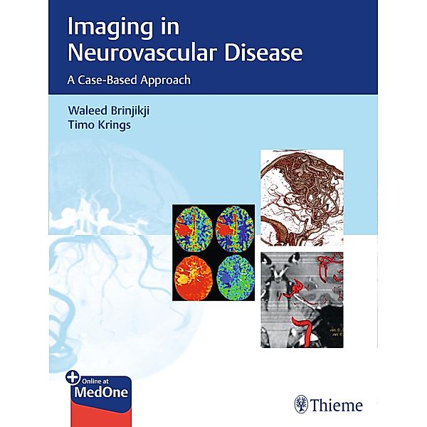 Imaging in Neurovascular Disease, Waleed Brinjikji, Timo Krings