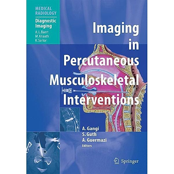 Imaging in Percutaneous Musculoskeletal Interventions