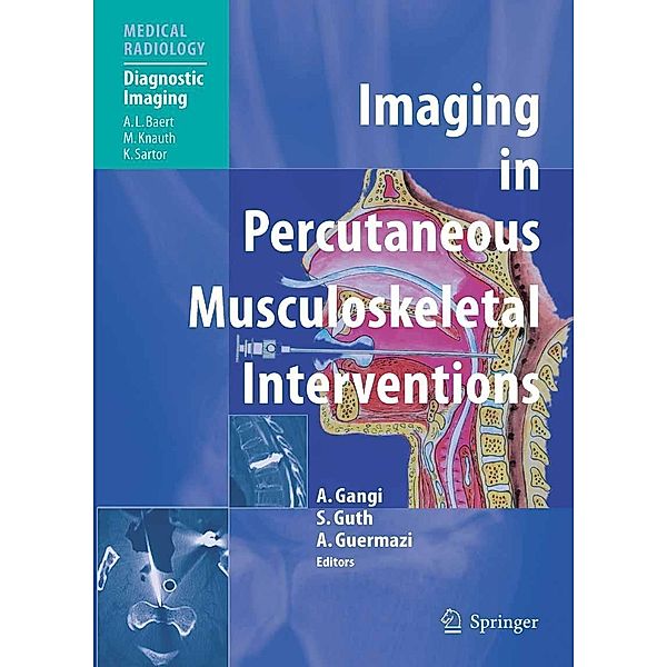 Imaging in Percutaneous Musculoskeletal Interventions / Medical Radiology, Ali Guermazi, Afshin Gangi, Stéphane Guth