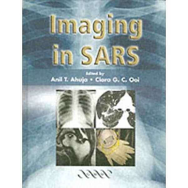 Imaging in SARS