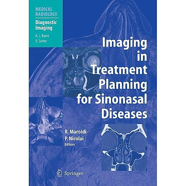 Imaging in Treatment Planning for Sinonasal Diseases / Medical Radiology