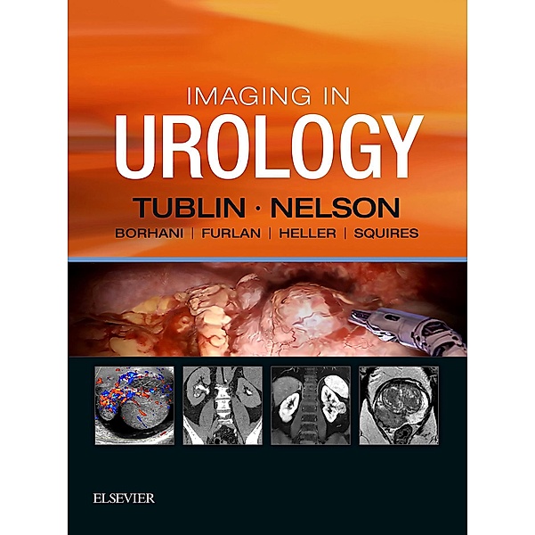 Imaging in Urology E-Book, Mitchell E. Tublin, Joel B Nelson