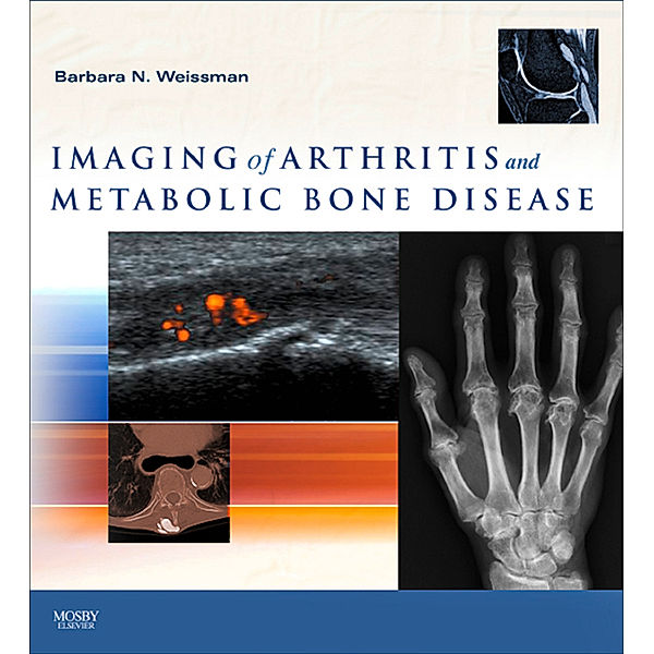 Imaging of Arthritis and Metabolic Bone Disease E-Book, Barbara N. W. Weissman