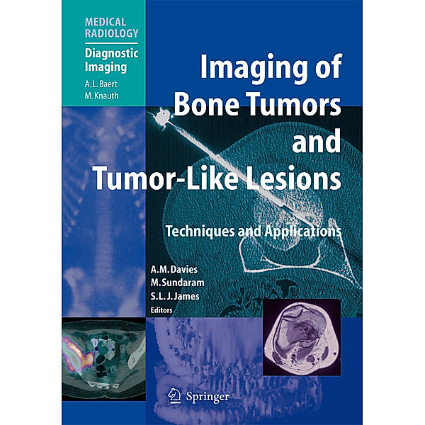 Imaging of Bone Tumors and Tumor-Like Lesions