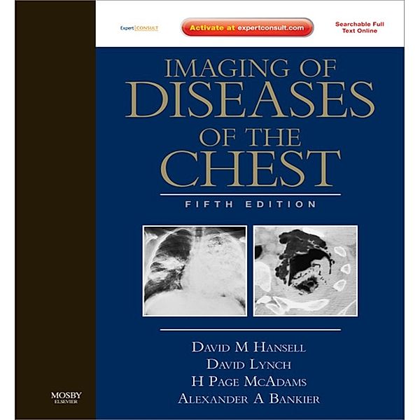 Imaging of Diseases of the Chest E-Book, David M. Hansell, Alexander A. Bankier, David A. Lynch, H. Page McAdams