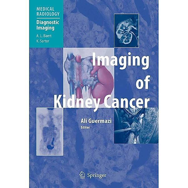 Imaging of Kidney Cancer / Medical Radiology
