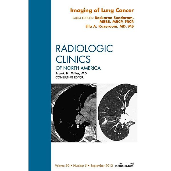 Imaging of Lung Cancer, An Issue of Radiologic Clinics of North America, Ella A. Kazerooni, Baskaran Sundaram