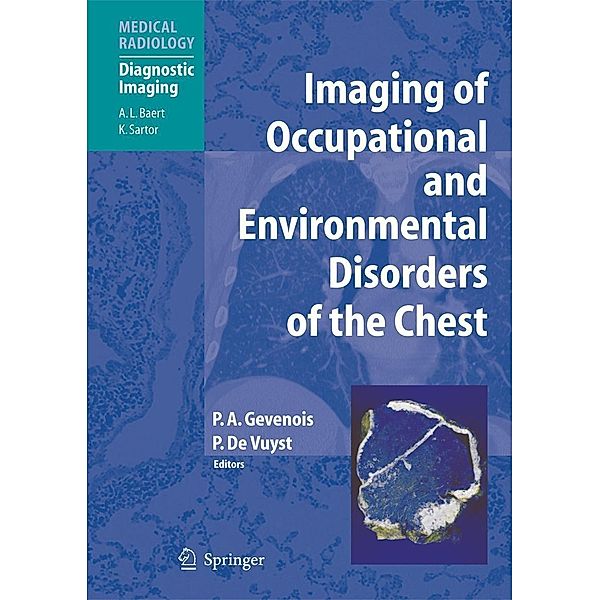 Imaging of Occupational and Environmental Disorders of the Chest / Medical Radiology