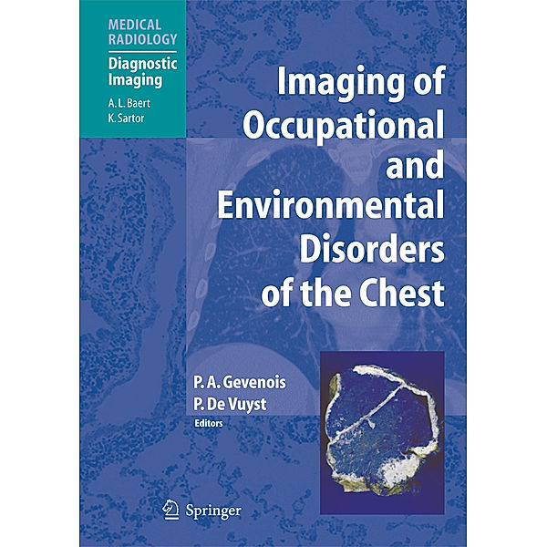 Imaging of Occupational and Environmental Disorders of the Chest