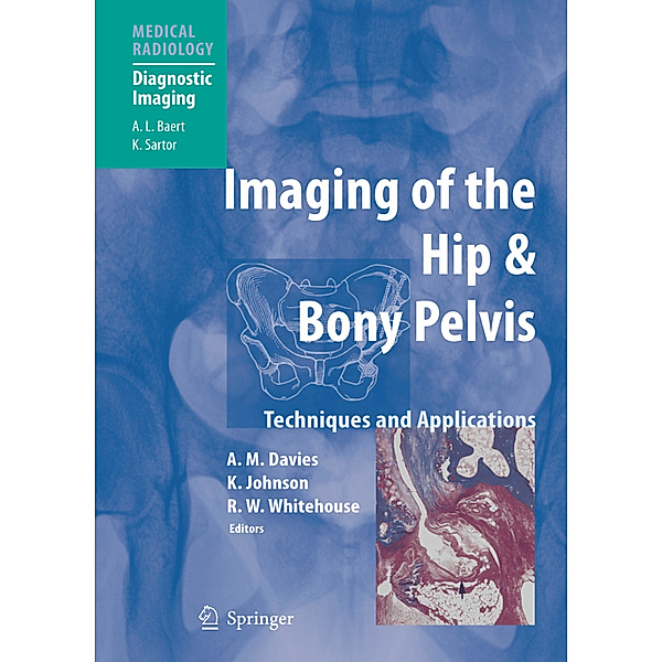 Imaging of the Hip & Bony Pelvis