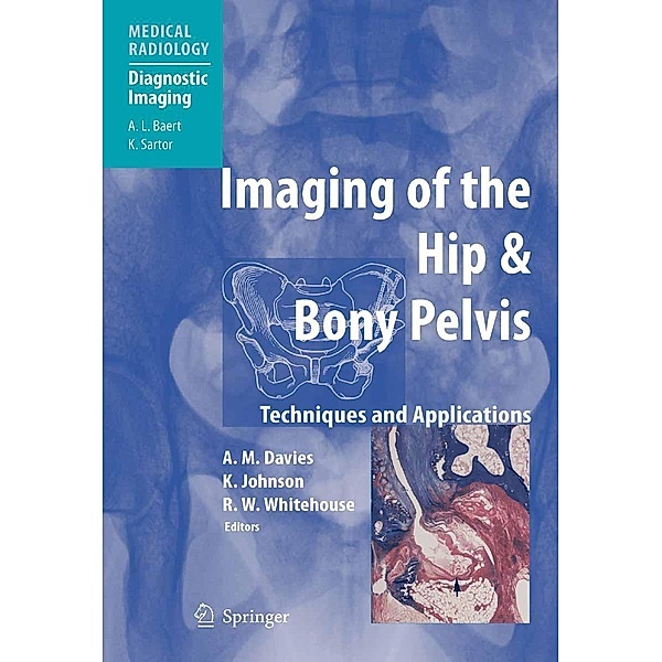 Imaging of the Hip & Bony Pelvis / Medical Radiology