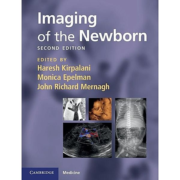 Imaging of the Newborn