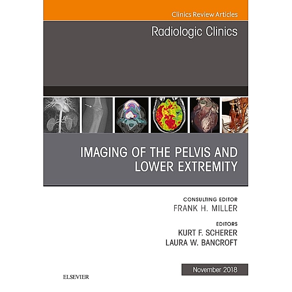 Imaging of the Pelvis and Lower Extremity, An Issue of Radiologic Clinics of North America, Laura Bancroft, Kurt Scherer