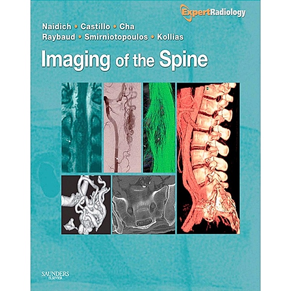 Imaging of the Spine E-Book, Thomas P. Naidich, Mauricio Castillo, James G. Smirniotopoulos, Spyros Kollias, Soonmee Cha, Charles Raybaud