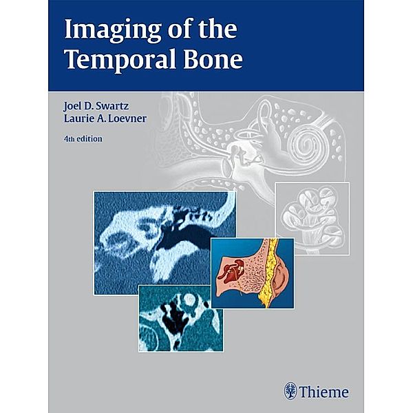 Imaging of the Temporal Bone, Joel D. Swartz, Laurie A. Loevner