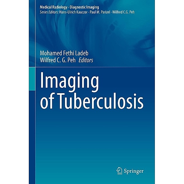 Imaging of Tuberculosis / Medical Radiology