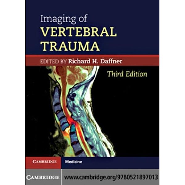 Imaging of Vertebral Trauma, Richard H. Daffner