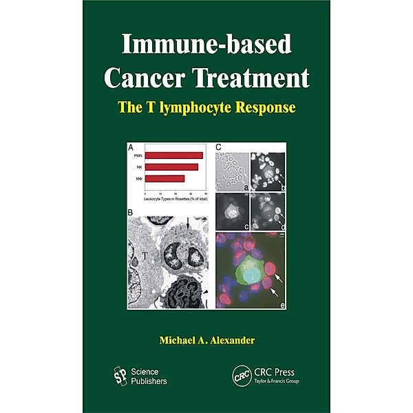 Immune-based Cancer Treatment