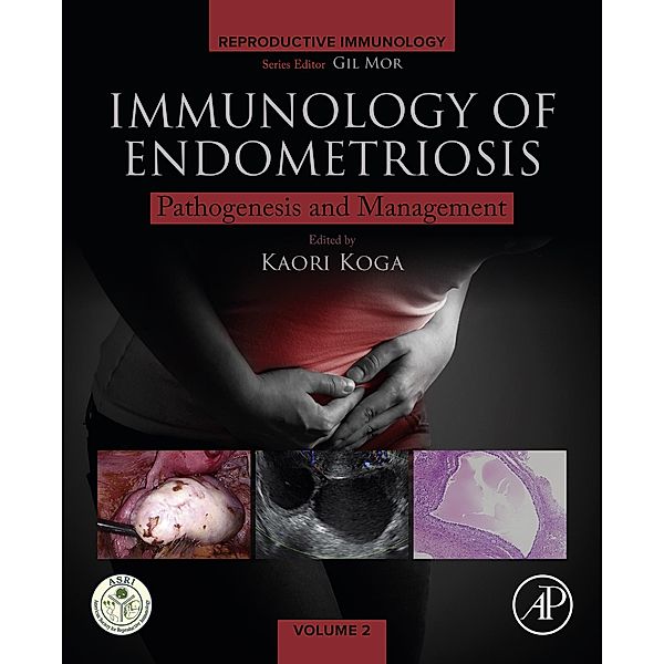 Immunology of Endometriosis