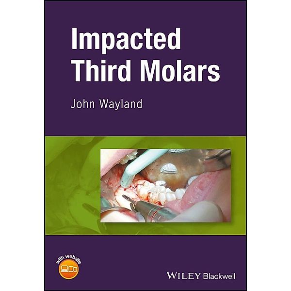 Impacted Third Molars, John Wayland