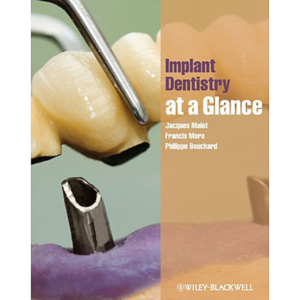 Implant Dentistry at a Glance, Jacques Malet, Francis Mora, Philippe Bouchard