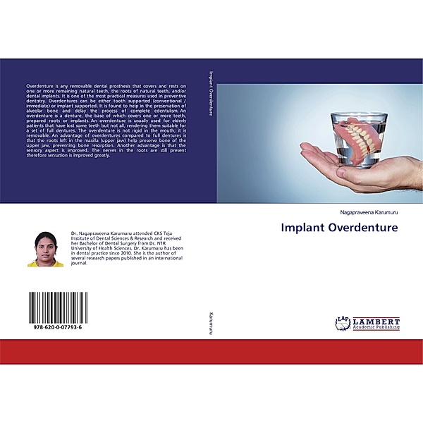 Implant Overdenture, Nagapraveena Karumuru