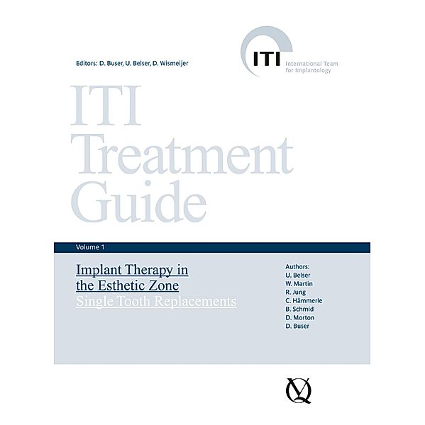 Implant Therapy in the Esthetic Zone / ITI Treatment Guide Series